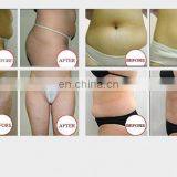 Popular Fat Freezing /cryolipolysis Slimming Machine/criolipolisys Machine thumbnail-3