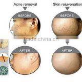 2016 Newest Pdt Led Light Therapy Lamp thumbnail-3