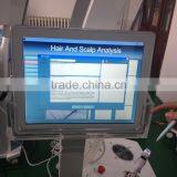 Laser Hair Regrowth Machine for Hair Loss Treatment thumbnail-6