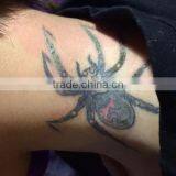 Tattoo Removal Laser Machine Q Switch Tattoo Removal Mongolian Spots Removal Machine/nd Yag Long Pulse Laser Telangiectasis Treatment thumbnail-4