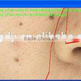 Portable Dialysis Machine/facial Skin Analyzer Machine Skin Scan/skin Analyser for Face thumbnail-6
