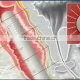 Multi-polar RF 2016 RF Tube Bags Under The Eyes Removal Hifu Machine Woman Vigina Tightening thumbnail-6