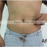 Professional Hifu Ultra Slim Body Shaper thumbnail-2