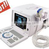 Hot Seller Full Digital Portable Ultrasound Scanner RUS-6000D With Convex Microconvex Probe thumbnail-1