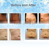 Body Contouring Cryo Cryolipolysis Cooling System Weight Fat Melting Loss Machine / Cryolipolysis Fat Reduction Machine thumbnail-6