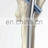 Orthopedic Trauma Implants PFNA thumbnail-6