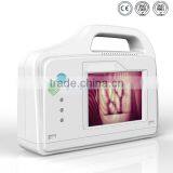 YSVV200 Guanghzou Hot Vein Illumination Device Price thumbnail-3