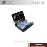 Hot Sale CMS600P2 B-Ultrasound Diagnostic System