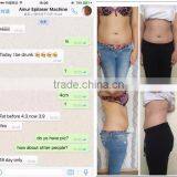 Fat Freezing Hottest Criolipolisis Lipo Cryo Fat Freezing Machine 2 Cryo Handles Cryolipolysis Slimming Machine 50 / 60Hz thumbnail-5