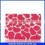 Top Level Cheapest Hard Cover Case for Macbook Air 11 thumbnail-5