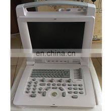 HC-A004 Cheapest Good Quality Medical Full Digital Portable Laptop B/W Ultrasound Scanner for Pregnancy thumbnail-3