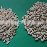 High Quality Bean Skin Peeling Machine/soybean Skin Removing Machine for Sale