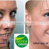 Cold Pressed Neem Oil thumbnail-5