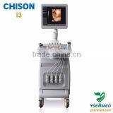 Mobile 4D Color Doppler Ultrasound Systme Chison Trolley Ultrasound