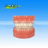 Orthodontic Teeth Model(normal Tooth, Invisible Brackets),dental Orthodontic Models thumbnail-1