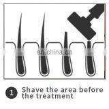 Ipl Home Use From Deess Ipl Home SPA Use Hair Removal & Skin Rejuvenation & Acne Clearance Machine thumbnail-3