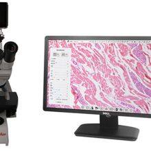 4K/1080P Adaptive Camera Industrial Camera Electron Microscope thumbnail-4