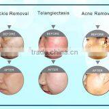 Laser Beauty Super Ipl Shr Hair Removal Machine thumbnail-3