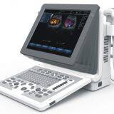 2D Эхокардиографический Цветной Доплеровский Ультразвуковой Сканирующий Аппарат thumbnail-1