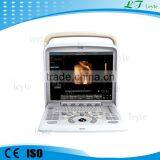 LTE5 Digital Doppler Color Ultrasound Machines