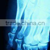x Ray Blue Film, Medical x Ray Film, Thermal ct Films China thumbnail-1