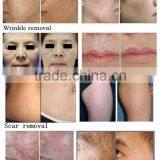 30W RF Mental Tube CO2 Laser Portable Fractional Acne Scar Removal Machine Professional thumbnail-3