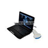 Low Factory Price!CE Approved Laptop Ultrasound Scanner RUS-9000F With 3.5Mhz Convex Probe thumbnail-3