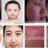 Beauty Cosmetics Laser Vascular Removal 980nm Diode Laser Spider Vein Removal Machine thumbnail-6