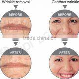 Skin Tightening Beauty Machine OD-R105 Face Lifting Portable rf Radio Frequency Facial Machine for Home Use thumbnail-5