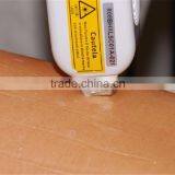 Hair Removal Feature and Laser Type Portable Diode Laser Hair Removal Epilator thumbnail-4