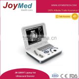 laptop vet ultrasound scanner/color doppler