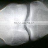 CE KND-A/F Medical Thermal x Ray Film China thumbnail-4