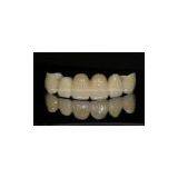 False Teeth Cercon/Zirconium Crown and Bridge False Teeth thumbnail-1