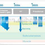 0.2-3.0J 7 Different Size Heads Hifu Wrinkle Removal Machine From Anybeauty Back Tightening thumbnail-5