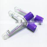 Edta K2 K3 Edta Blood Collection Tubes thumbnail-6