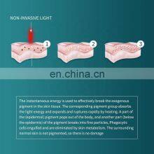 Non Invasive Q Switch ND Yag Laser Machine Tattoo Removal Laser Machine Eyebrow Pigment Scars Freckle Removal Beauty Instrument thumbnail-5