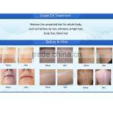 Factory Price Touch Screen Permanetly and Immediately Beauty Machine 808 Hair Remove thumbnail-6