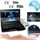 CE FDA Mark 10 Inch Laptop Veterinary / Vet Ultrasound Scanner With 3.5MHz Convex Probe Rectal With USB Port thumbnail-1