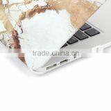 Marble Case Covers for Macbook Pro 13"/15", Hot Stylish Case for Macbook Pro thumbnail-5