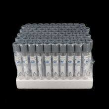Glucose Blood Collection Tube Disposable Vacuum Plasma Blood Collection Tube for Blood Glucose Determination thumbnail-4