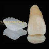 Ultra-thin Dental Veneers, Porcelain Veneer, Dental Laminates, Laboratoire Dentaire, Dentallabor, Laboratorio Dental, Dental Laboratory, Shenzhen LJ Dental Lab China thumbnail-2
