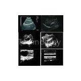 Ultrasound Scanner Bio 200C+ / CE Approved Medical Equipment thumbnail-1