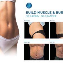 EMS Muscle Stimulator Machine RF Body Sculpting Radio Frequency Abdomen Arms Leg Pelvic Floor Pelvic thumbnail-5