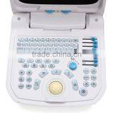 2015 New Full Digital Portable Ultrasound Scanner (PC) thumbnail-4
