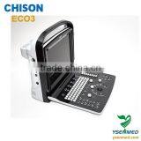 Medical Hospital B/w 2d Portable Ultrasound Chison Eco3 Price