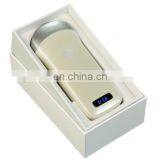 Mini Ultrasound Scan Machine / Medical Ultrasound Scanner Probe / Wireless Ultrasound thumbnail-3