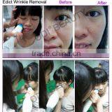 (CE Certificated) Non Surgical Mesotherapy Facial Firming Machine for Wrinkle Reduction&Fine Line Care R80 thumbnail-3