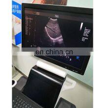 2020 Hot Sale Popular CE Certificate 4D Trolley Color Doppler Ultrasound Machine thumbnail-3