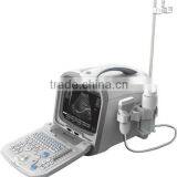 Portable Ultrasound Scanner Digital Model thumbnail-1