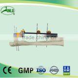 Proximal Ulna Radius Fractures Orthopedic External Fixation